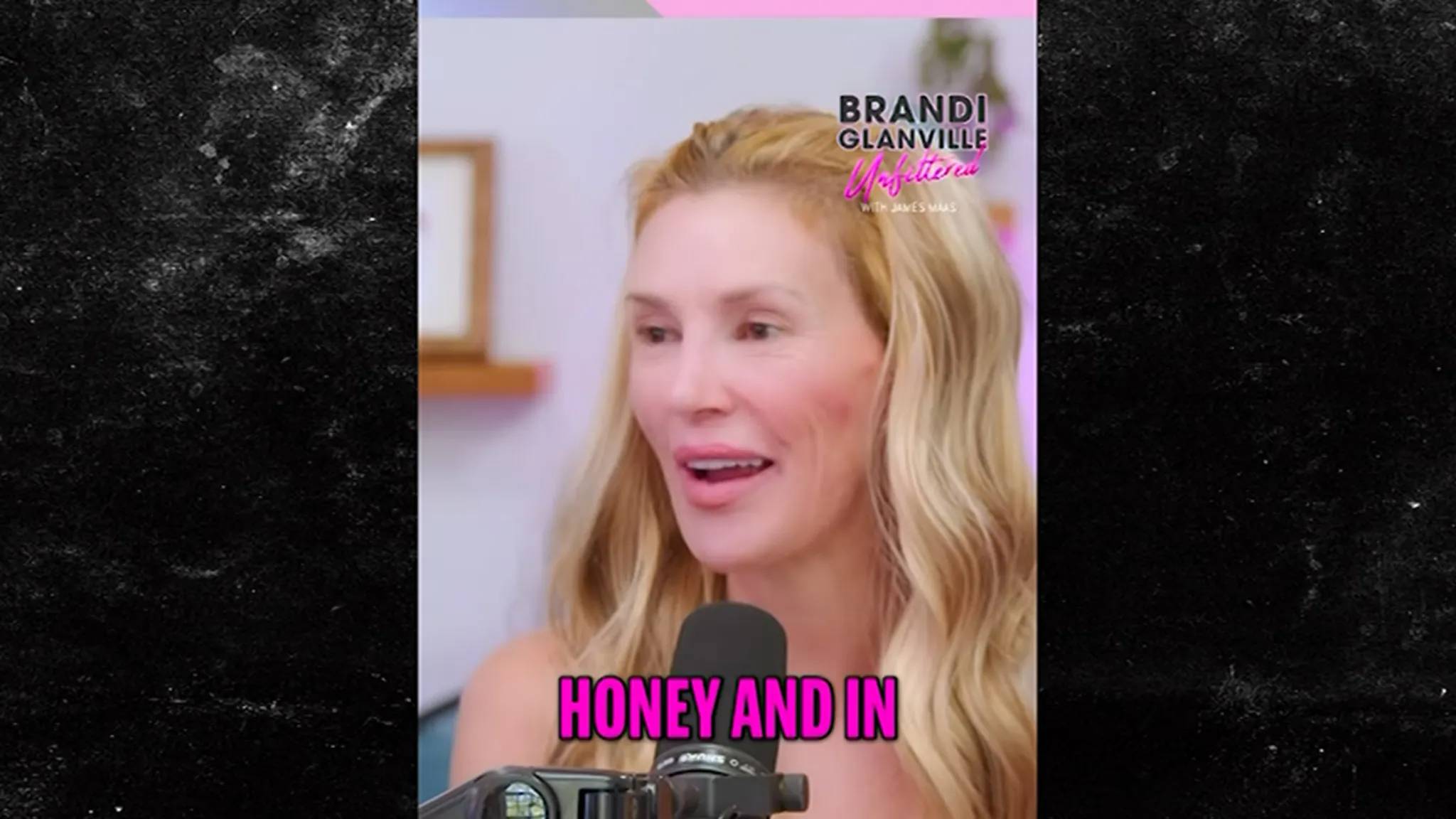 Brandi Glanville Says She May Have ‘Sexually Transmitted Ringworm’