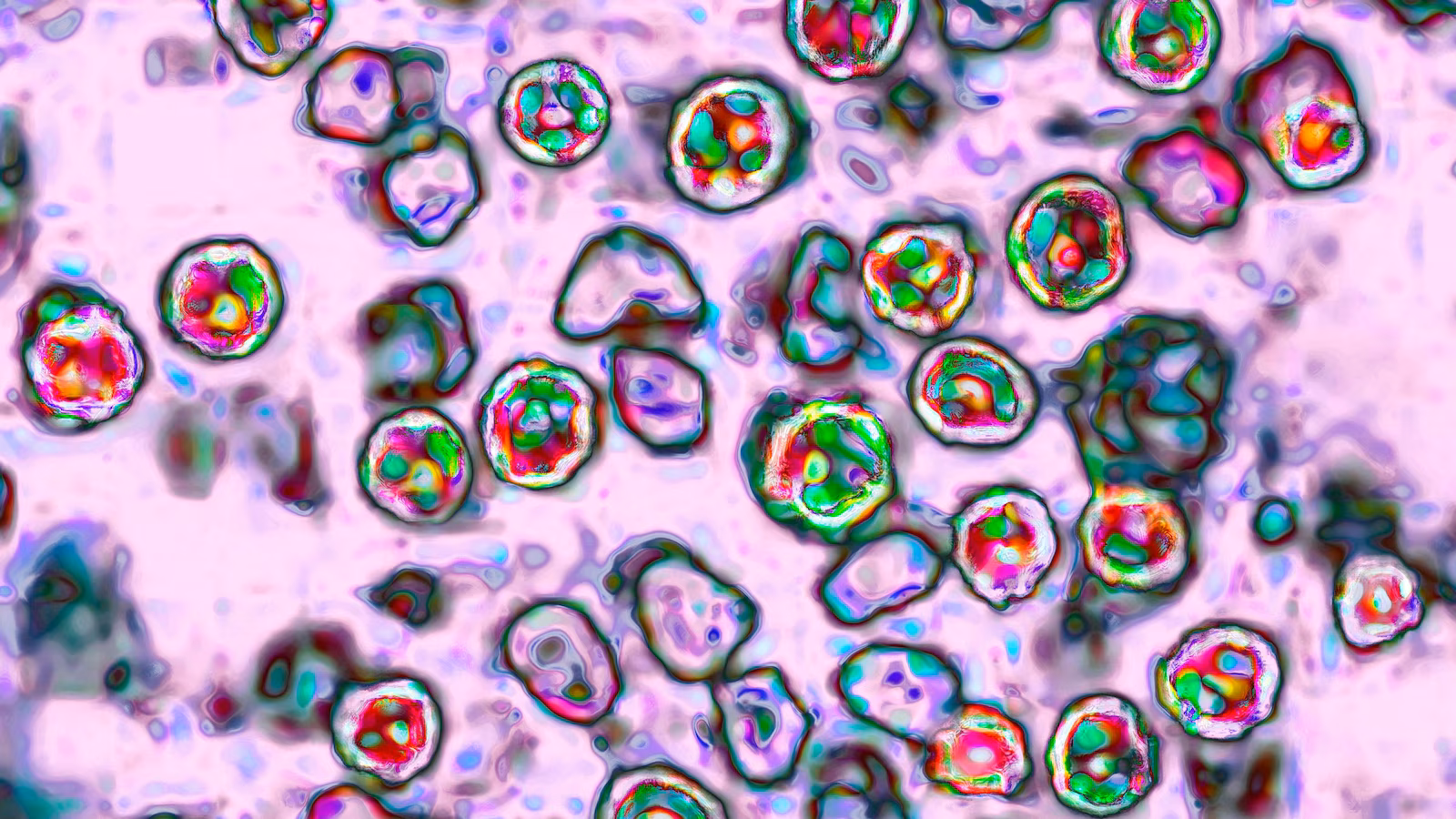One other measles-related loss of life reported in Pennsylvania as outbreak grows